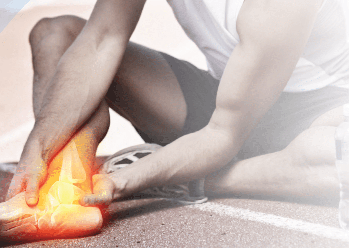 Acute Ankle Injuries Sprains Strains And Fractures East Sydney